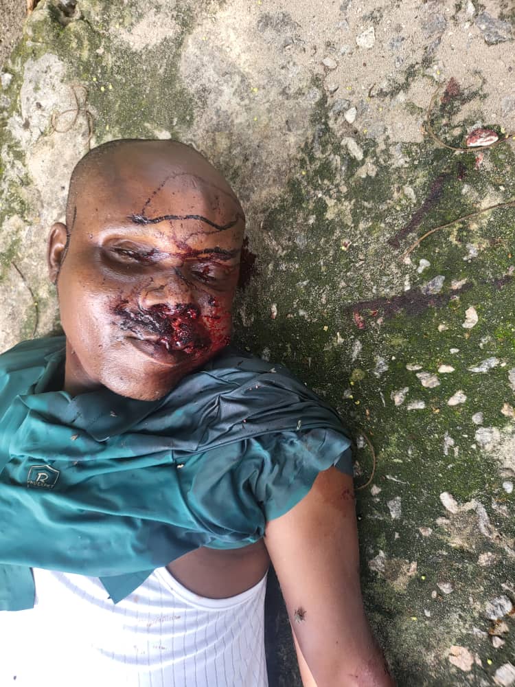 Edjekota, Ewu Land Dispute: Two Killed, Many Sustain Injuries In Delta